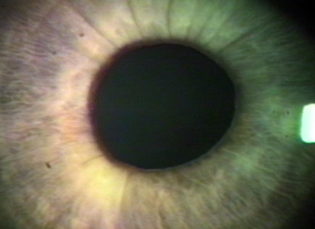 Adies pupil color